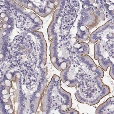 Immunohistochemistry-Paraffin: Myosin 1A Antibody [NBP2-55431]