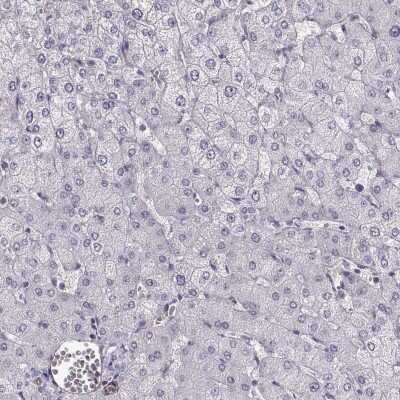 Immunohistochemistry-Paraffin: Myosin 1A Antibody [NBP2-55431]