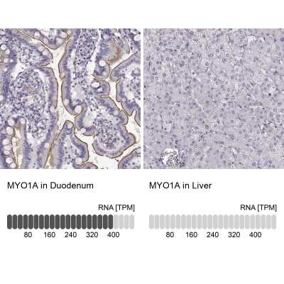 Immunohistochemistry-Paraffin: Myosin 1A Antibody [NBP2-55431]