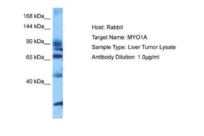 Western Blot: Myosin 1A Antibody [NBP2-85350]