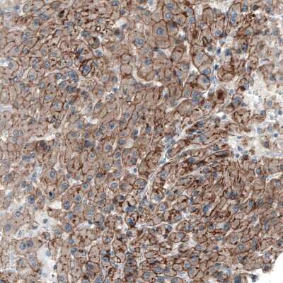 Immunohistochemistry-Paraffin: Myosin 1B Antibody [NBP1-87739]