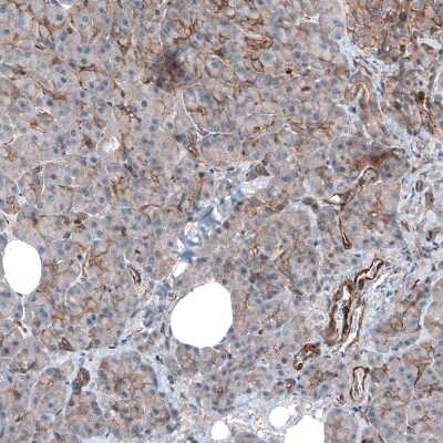 Immunohistochemistry-Paraffin: Myosin 1B Antibody [NBP1-87739]