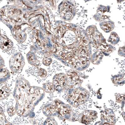 Immunohistochemistry-Paraffin: Myosin 1B Antibody [NBP1-87739]