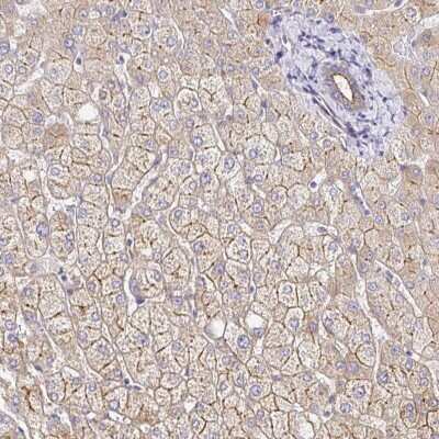 Immunohistochemistry-Paraffin: Myosin 1B Antibody [NBP2-38888]