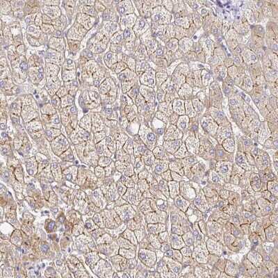 Immunohistochemistry-Paraffin: Myosin 1B Antibody [NBP2-38888]