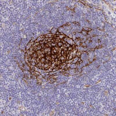 Immunohistochemistry-Paraffin: Myosin 1B Antibody [NBP2-38888]