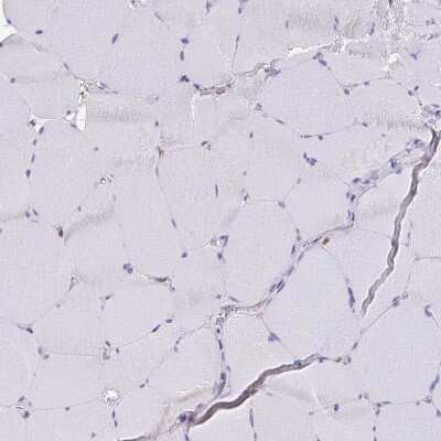 Immunohistochemistry-Paraffin: Myosin 1B Antibody [NBP2-38888]