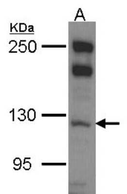 Western Blot: Myosin 1B Antibody [NBP2-19453]