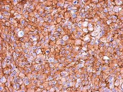Immunohistochemistry-Paraffin: Myosin 1C Antibody [NBP2-19454]