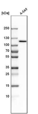 Western Blot: Myosin 1C Antibody [NBP1-87745]