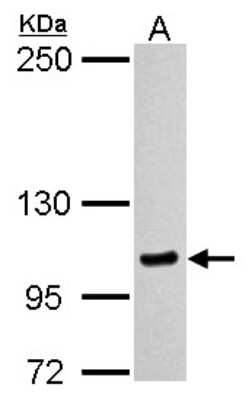 Western Blot: Myosin 1C Antibody [NBP2-19454]