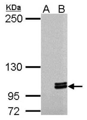 Western Blot: Myosin 1C Antibody [NBP2-19454]