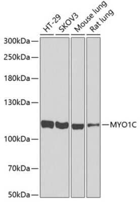 Western Blot: Myosin 1C AntibodyBSA Free [NBP2-95224]