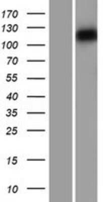 Western Blot: Myosin 1C Overexpression Lysate [NBL1-13437]