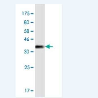 Western Blot: Myosin 1E Antibody (7A5) [H00004643-M02-100ug]