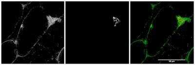 Immunocytochemistry/ Immunofluorescence: Myosin 5a Antibody [NBP1-49858]