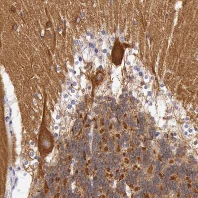 Immunohistochemistry-Paraffin: Myosin 5a Antibody [NBP1-92156]