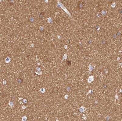 Immunohistochemistry-Paraffin: Myosin 5a Antibody [NBP1-92156]