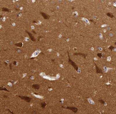 Immunohistochemistry-Paraffin: Myosin 5a Antibody [NBP1-92156]