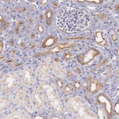 Immunohistochemistry-Paraffin: Myosin 5a Antibody [NBP1-92156]