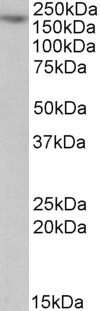 Western Blot: Myosin 5a Antibody [NBP1-49858]