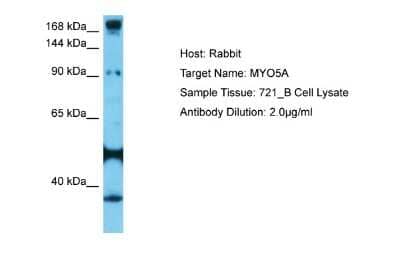 Western Blot: Myosin 5a Antibody [NBP2-85351]