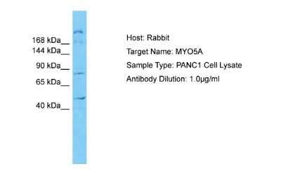 Western Blot: Myosin 5a Antibody [NBP2-85351]