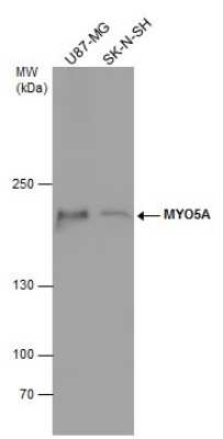 Western Blot: Myosin 5a Antibody [NBP3-12951]