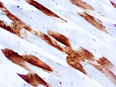 Immunohistochemistry-Paraffin: Myosin Heavy Chain 1 Antibody (MY32) [NBP1-22811]