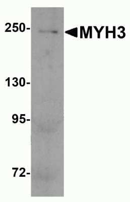 Western Blot: Myosin Heavy Chain 3 AntibodyBSA Free [NBP2-81968]