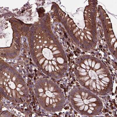 Immunohistochemistry-Paraffin: Myosin heavy chain 14 Antibody [NBP2-49626]