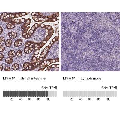 Immunohistochemistry-Paraffin: Myosin heavy chain 14 Antibody [NBP2-49533]