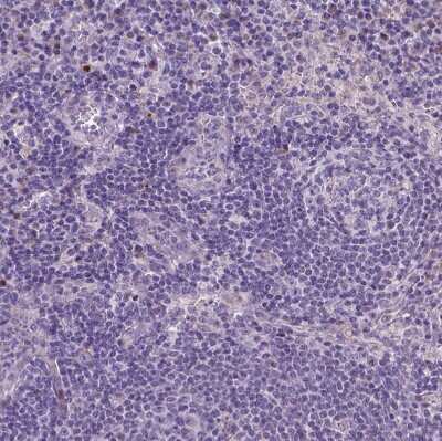 Immunohistochemistry-Paraffin: Myosin heavy chain 14 Antibody [NBP2-49533]