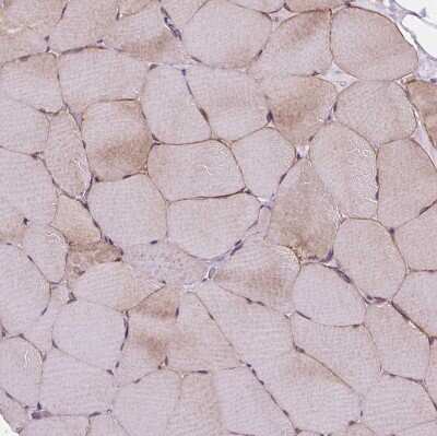 Immunohistochemistry-Paraffin: Myosin heavy chain 14 Antibody [NBP2-49533]