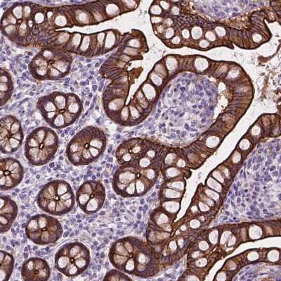Immunohistochemistry-Paraffin: Myosin heavy chain 14 Antibody [NBP2-49533]