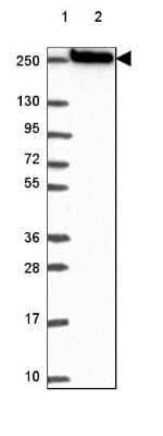 Western Blot: Myosin heavy chain 14 Antibody [NBP2-49533]