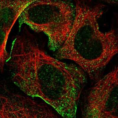 Immunocytochemistry/ Immunofluorescence: Myosin IXA Antibody [NBP1-92160]