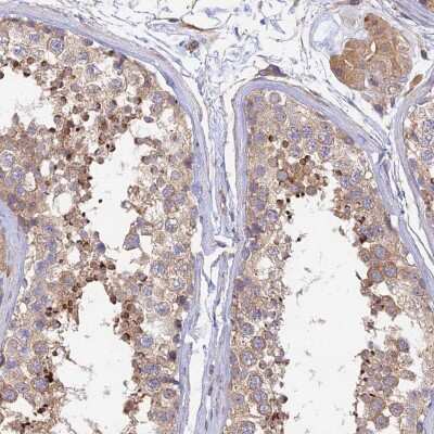 Immunohistochemistry-Paraffin: Myosin IXA Antibody [NBP1-92159]