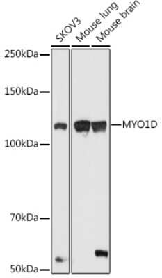 Western Blot: Myosin-Id AntibodyAzide and BSA Free [NBP3-16034]