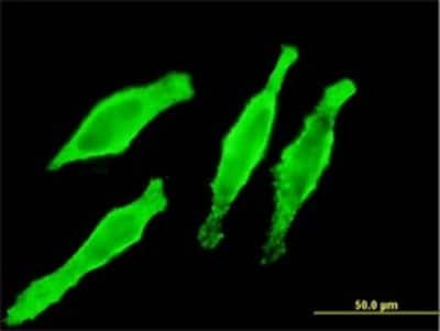 Immunocytochemistry/ Immunofluorescence: Myosin Light Chain 2 Antibody (3B9-B4) [H00004633-M01]