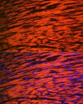 Immunohistochemistry: Myosin Light Chain 2 Antibody (5M6Q8) [NBP3-16693]