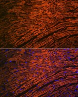 Immunohistochemistry: Myosin Light Chain 2 Antibody (5M6Q8) [NBP3-16693]