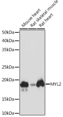 Western Blot: Myosin Light Chain 2 Antibody (5M6Q8) [NBP3-16693]