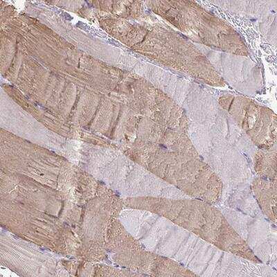 Immunohistochemistry: Myosin Light Chain 2 Antibody [NBP1-85541]