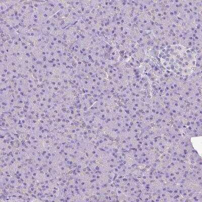 Immunohistochemistry: Myosin Light Chain 2 Antibody [NBP1-85541]