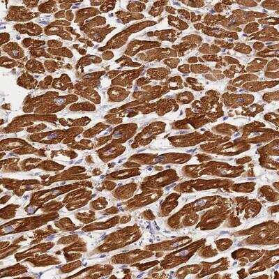 Immunohistochemistry: Myosin Light Chain 2 Antibody [NBP2-13634]