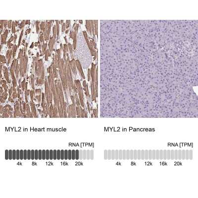 Immunohistochemistry-Paraffin: Myosin Light Chain 2 Antibody [NBP1-85541]