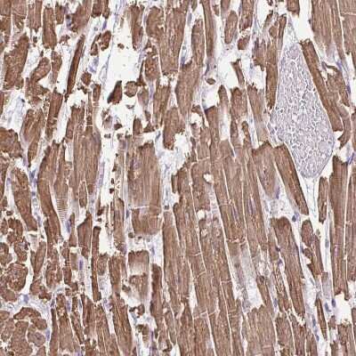 Immunohistochemistry-Paraffin: Myosin Light Chain 2 Antibody [NBP1-85541]