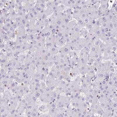 Immunohistochemistry-Paraffin: Myosin Light Chain 2 Antibody [NBP1-85541]