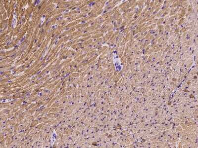 Immunohistochemistry-Paraffin: Myosin Light Chain 2 Antibody [NBP2-99552]
